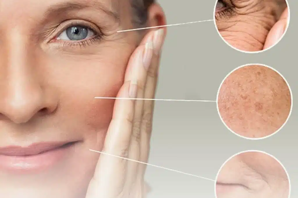 Anti-Aging (Yaşlanma Karşıtı) Tedavisi