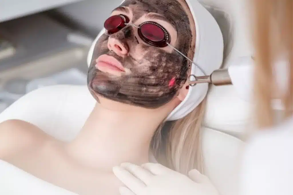 Pico Lazer Teknolojisi İle Karbon Peeling
