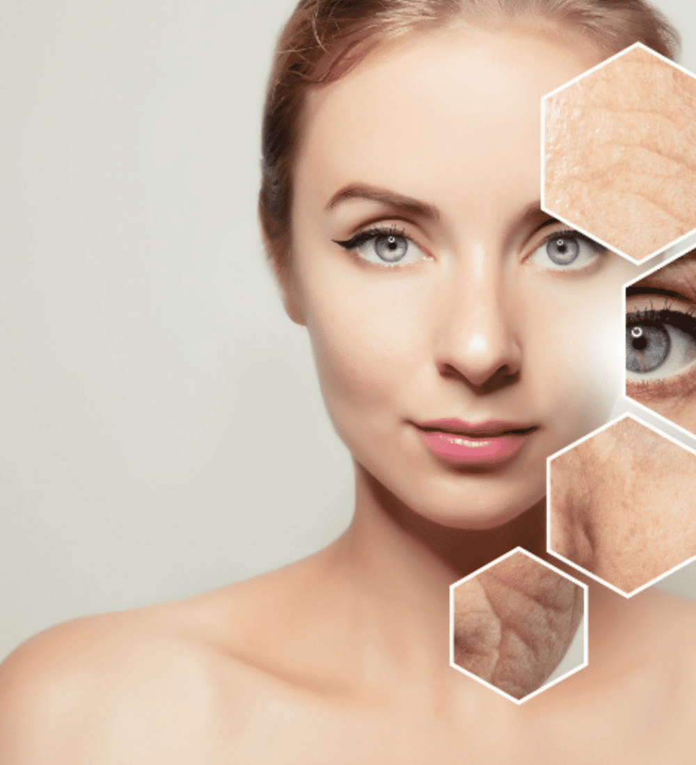 Anti Aging