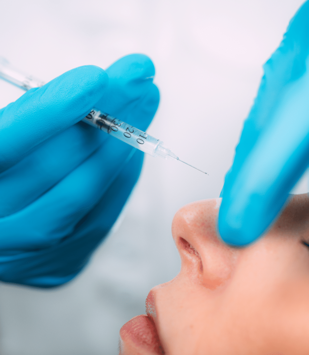 Non-Surgical Rhinoplasty (Nose Filler)