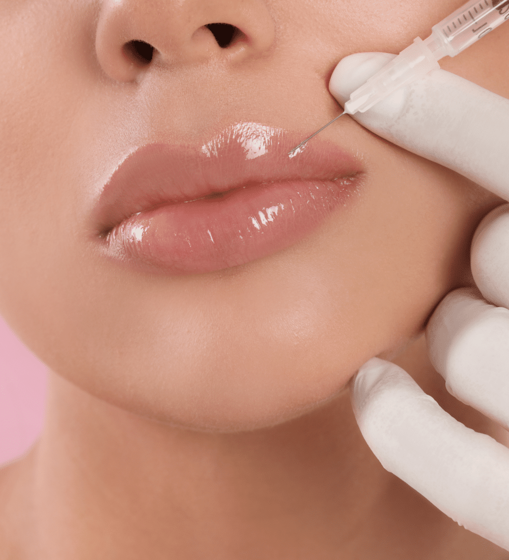 Lip Filler