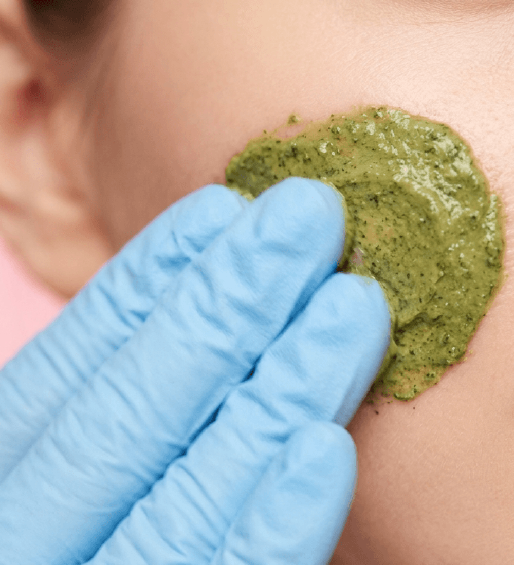 green-peeling (